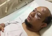 Tiba-tiba, Ini Komentar Setya Novanto Soal Penyiraman Air Keras Novel Baswedan Tiba-tiba, Ini Komentar Setya Novanto Soal Penyiraman Air Keras Novel Baswedan