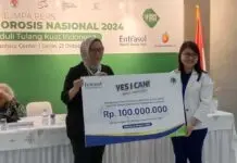 Perwatusi: Masyarakat Harus Pahami Pentingnya Jaga Kesehatan Tulang